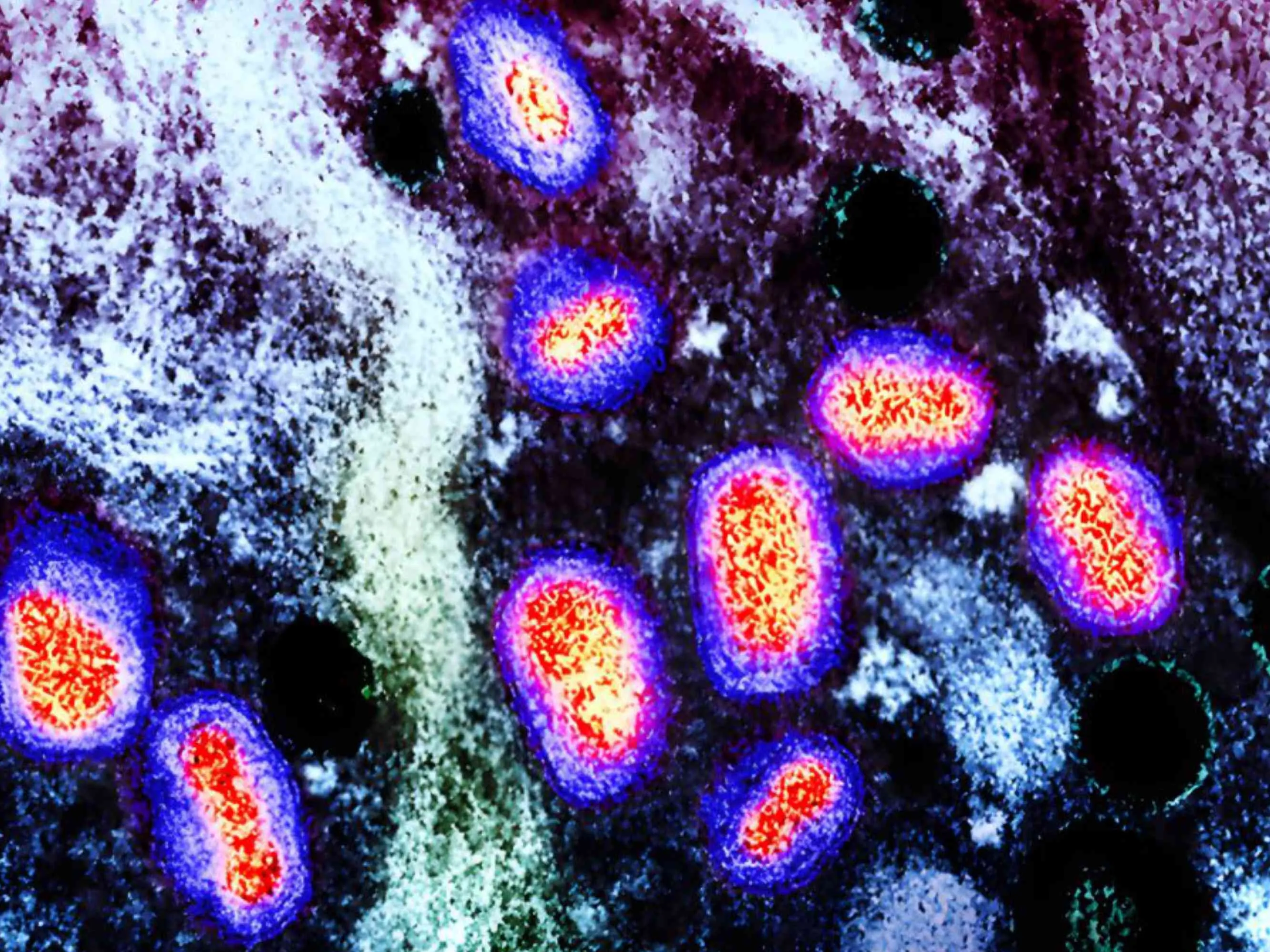 Mpox (anteriormente conocido como viruela del mono) 