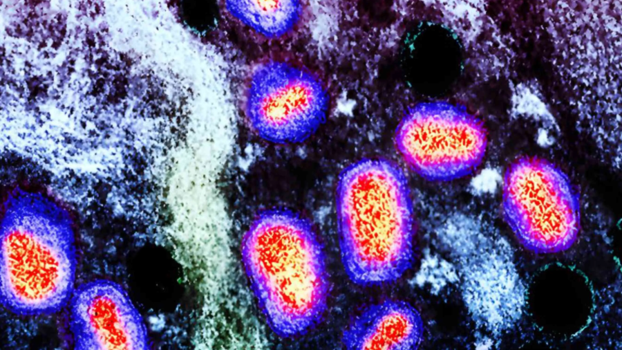 Mpox (anteriormente conocido como viruela del mono) 